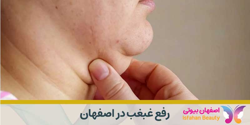 رفع غبغب در اصفهان