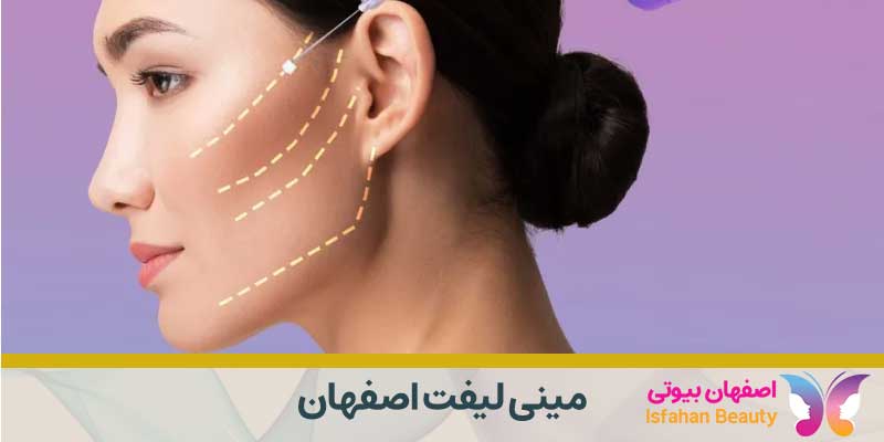 مینی لیفت اصفهان