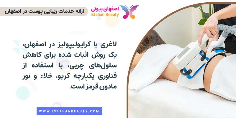 لاغری با کرایولیپولیز در اصفهان
