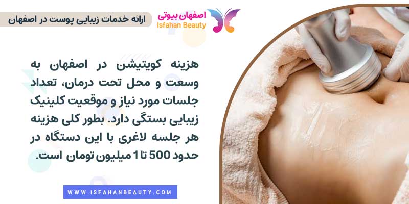 هزینه کویتیشن در اصفهان