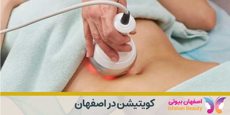 کویتیشن در اصفهان