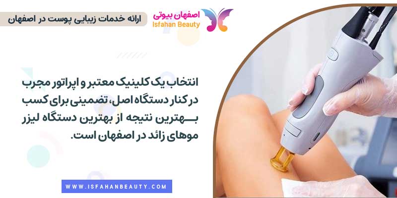 بهترین دستگاه لیزر موهای زائد در اصفهان کدام است؟