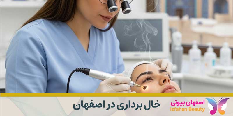 خال برداری در اصفهان