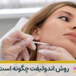 روش اندولیفت چگونه است؟