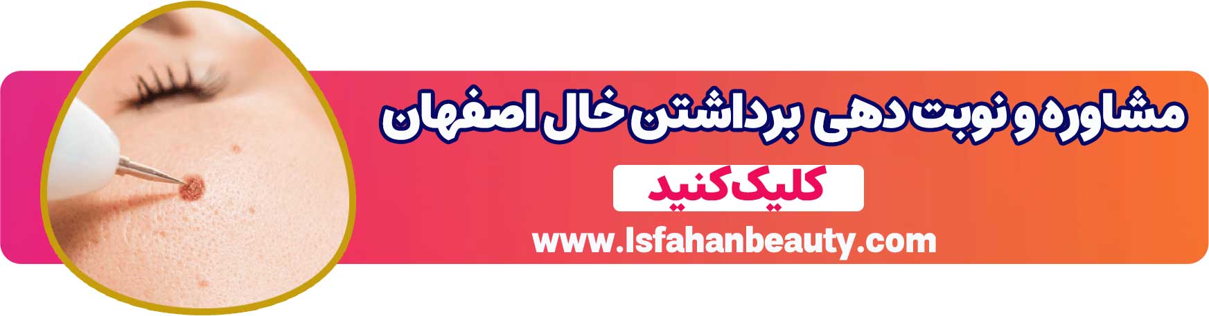 مشاوره و نوبت دهی برداشتن خال در اصفهان