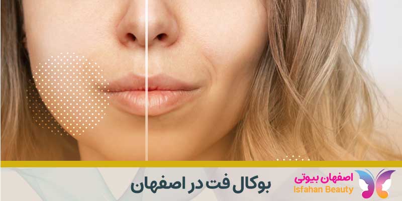 بوکال فت در اصفهان