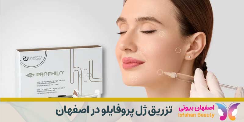 تزریق ژل پروفایلو در اصفهان