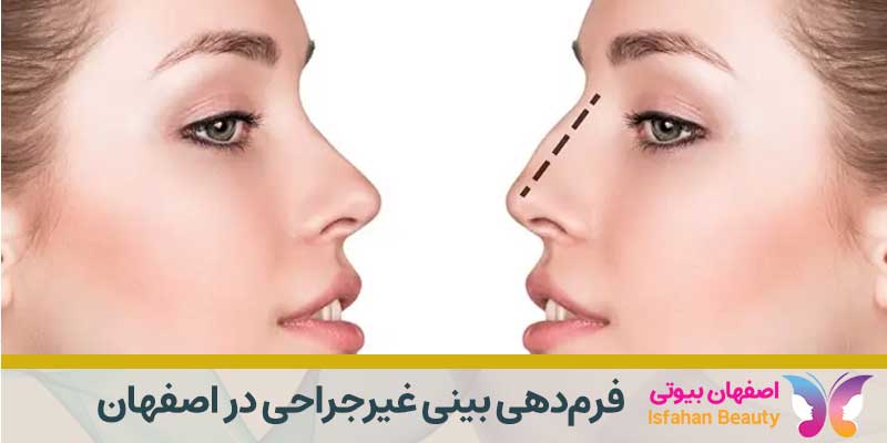 فرم‌دهی بینی غیرجراحی در اصفهان