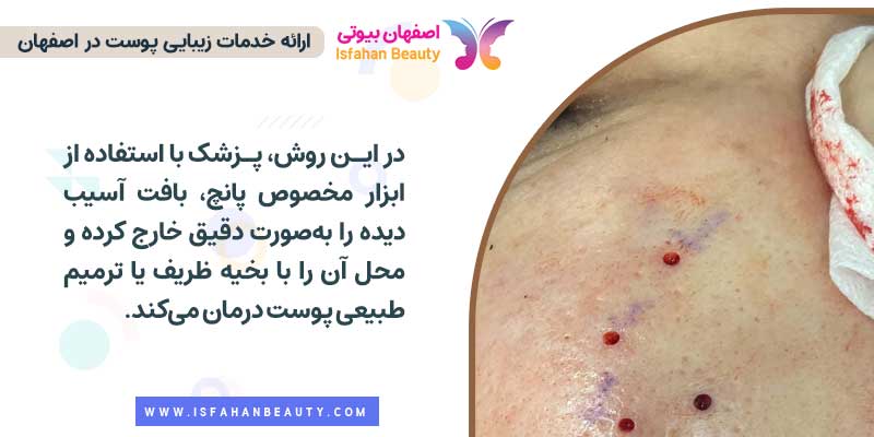 عملکرد دستگاه پانچ صورت