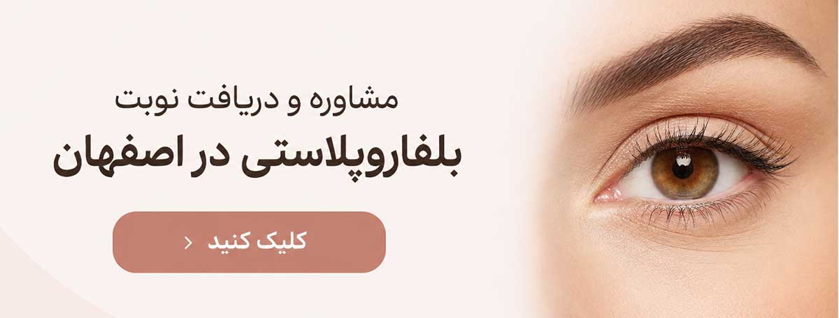 بلفاروپلاستی در اصفهان