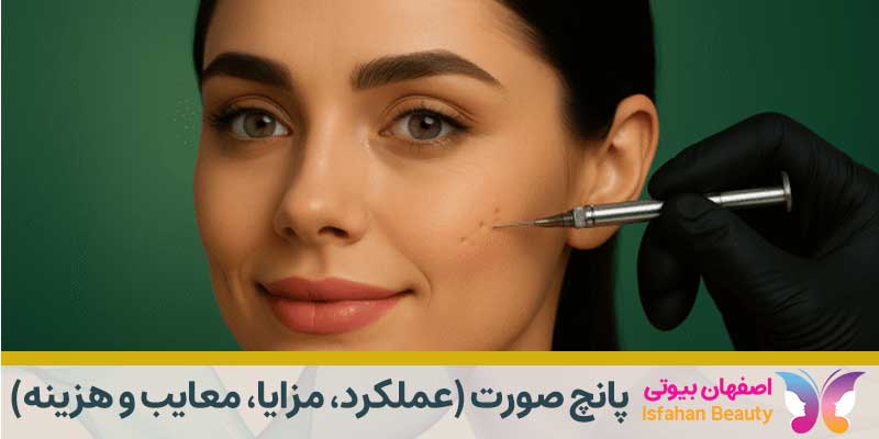 پانچ صورت